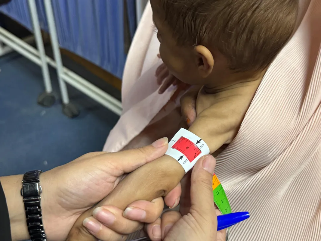Malnutrition in Southern Afghanistan