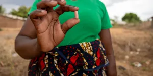 Living with HIV/Aids through Conflict and Displacement - Macomia