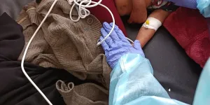 Measles threatens the lives of children in Dhamar Governorate