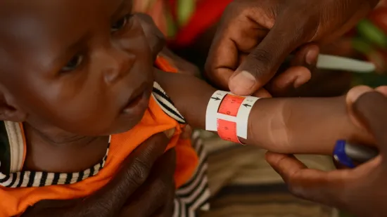 Malnutrition in Zamzam