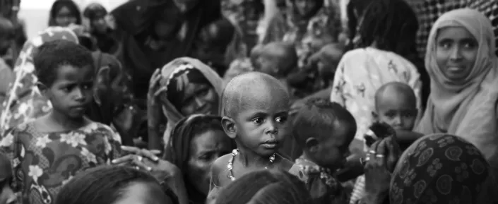 Unternährung in der Region Afar in Äthopien