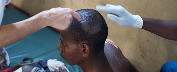 Ein Verwundeter wird in der Klinik von Ärzte ohne Grenzen im Mpoko Lager am Flughafen Bangui versorgt.