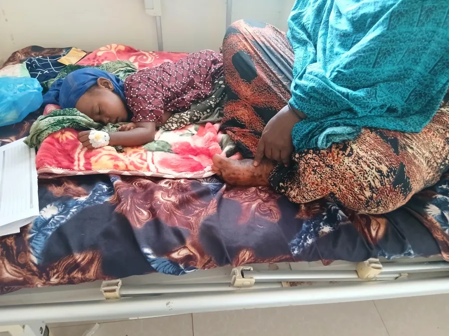 When Measles Meets Malnutrition – Halima Abdi Adan’s Ordeal