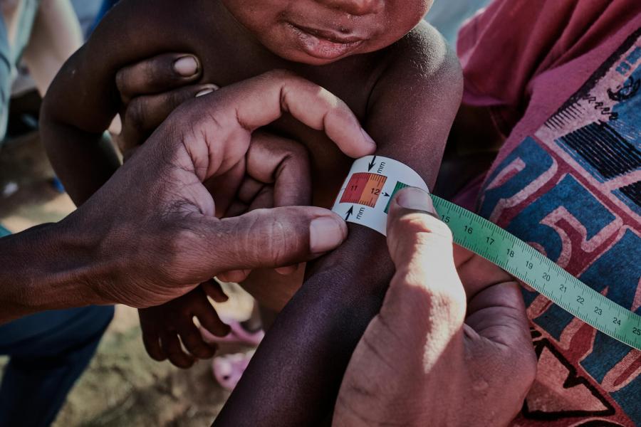 Malnutrition emergency: mobile clinic in Ranobe