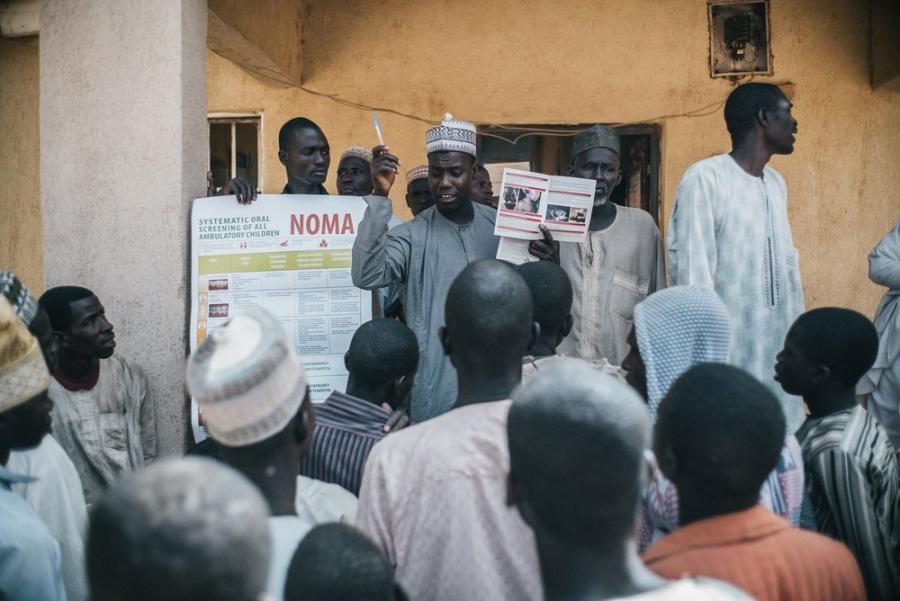 MSF Outreach Team, Sokoto Noma Hospital