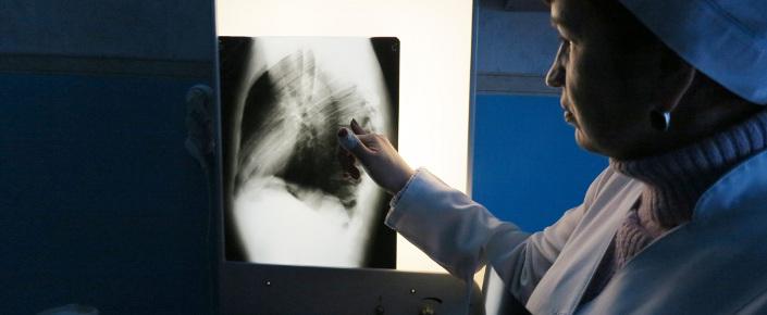 Eine Krankenschwester betrachtet die Röntgenbilder eines von Ärzte ohne Grenzen betreuten Tuberkulose-Patienten.