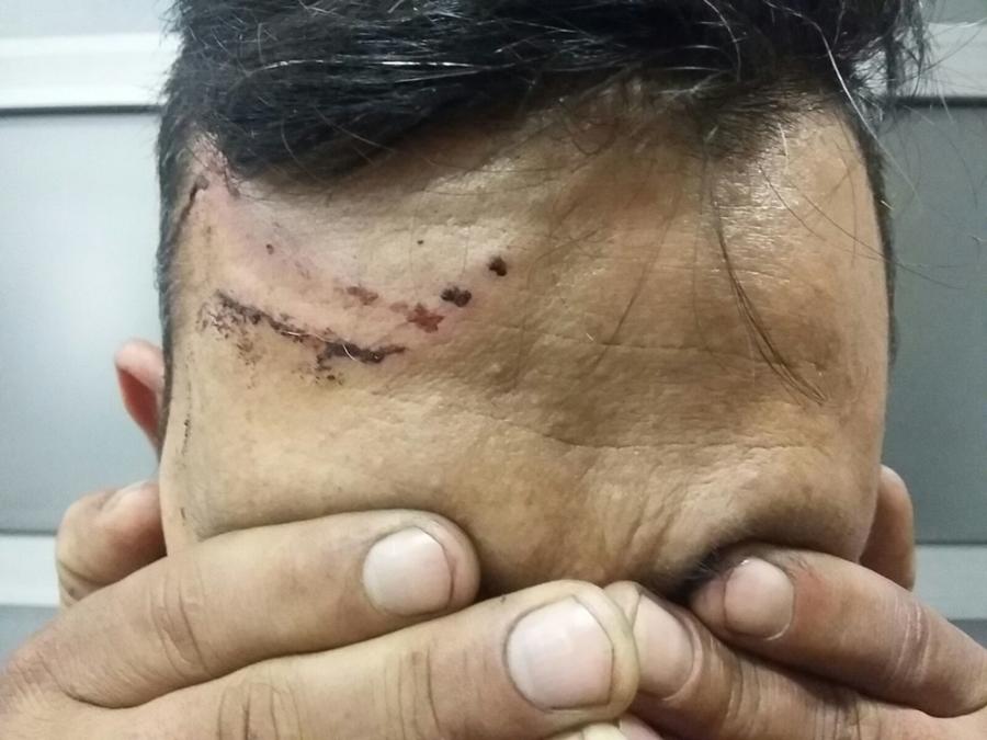 Alleged Police Abuse On The Hungarian Border Alleged Police Abuse On The Hungarian Border