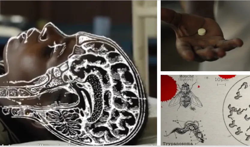 Ein Wunsch wird wahr: Pille gegen die Schlafkrankheit