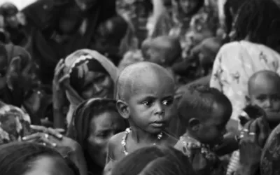 Unternährung in der Region Afar in Äthopien