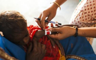 Ärzte ohne Grenzen führt im Bezirk Darbhanga ambulante und stationäre Behandlungen für betroffene Kinder durch.