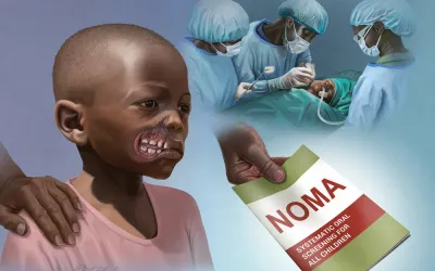 Noma
