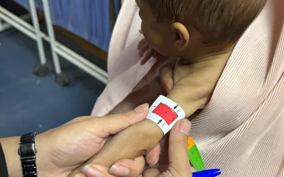 Malnutrition in Southern Afghanistan