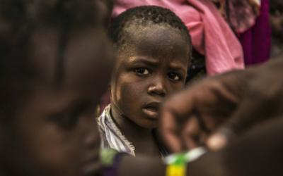 Im Dorf Tounfafi, wo rund 6.000 Menschen leben, wurde die saisonale Malaria-Chemoprävention durchgeführt. Vor allem die Kombination aus Mangelernährung und Malaria ist für Kinder fatal.