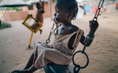 Maryam, noma survivor