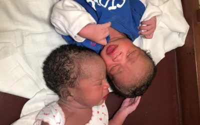 Kamerun: Überraschend Zwillinge