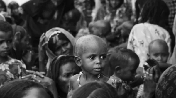Unternährung in der Region Afar in Äthopien