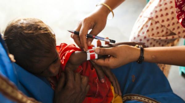 Ärzte ohne Grenzen führt im Bezirk Darbhanga ambulante und stationäre Behandlungen für betroffene Kinder durch.