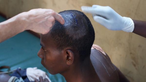 Ein Verwundeter wird in der Klinik von Ärzte ohne Grenzen im Mpoko Lager am Flughafen Bangui versorgt.