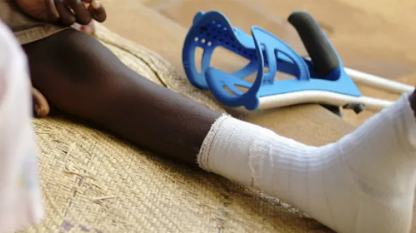 PatientInnen der chronischen Hautinfektion Buruli-Ulkus leiden unter großen Wunden, die nur sehr schwer heilen.