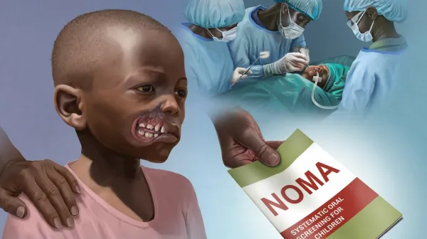 Noma