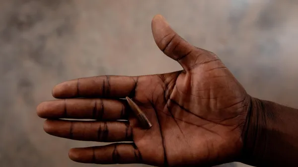 The journey of a wounded woman at MSF'SICA hospital in Bangui