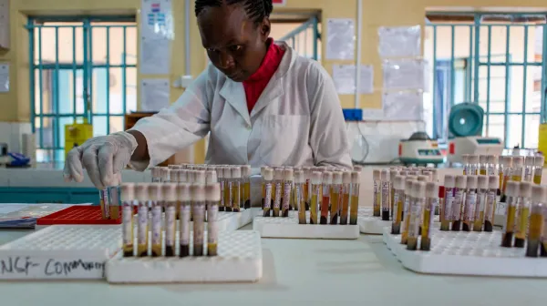 Advanced HIV management in Homa Bay