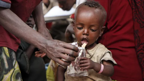 Nutrition centers for malnourished people (severe and modaretely cases)