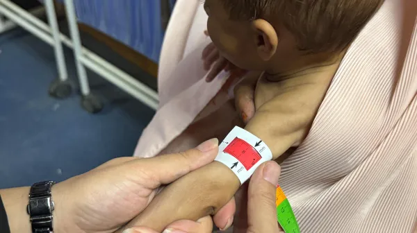 Malnutrition in Southern Afghanistan