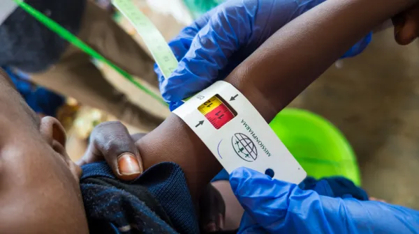 Shocking malnutrition levels in Baidoa