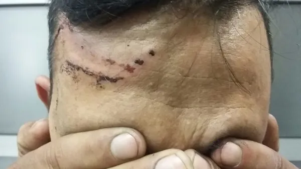 Alleged Police Abuse On The Hungarian Border
