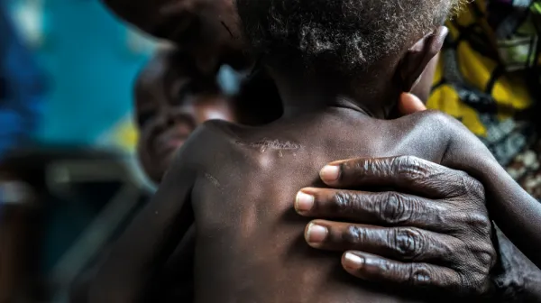Responding to the violent conflict in Kasai, DRC