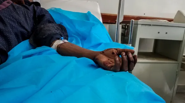 Victims of airstrike in Sanaa