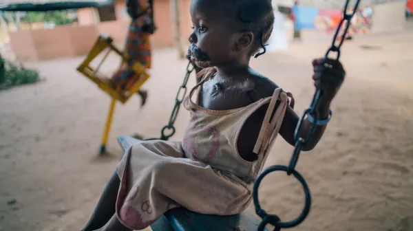 Maryam, noma survivor