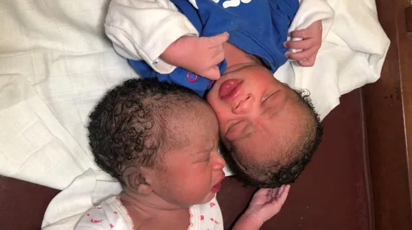 Kamerun: Überraschend Zwillinge