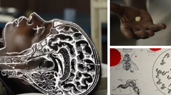 Ein Wunsch wird wahr: Pille gegen die Schlafkrankheit